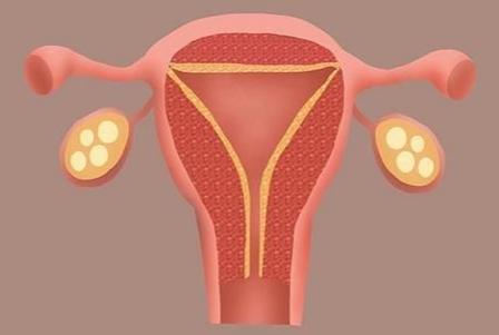 子宮內(nèi)膜薄總懷不上？