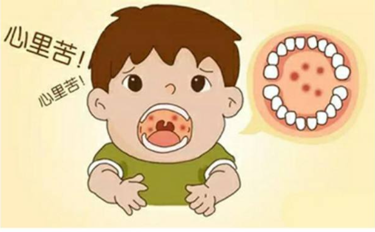 夏季高發(fā)的這種病不是口腔潰瘍！